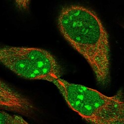 HUCE1 Antibody, Novus Biologicals 25 &mu;L; Unlabeled:Antibodies, Polyclonal